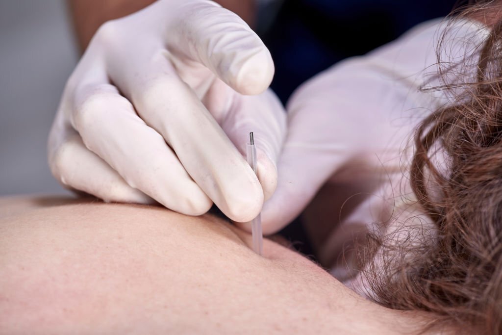 In Step® Massage Therapy Provides Best Trigger Point Massage Therapy In Edmonton. We Focuses On Vareity Of Lymphatic Massage Services.