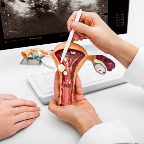 An Anatomical Model Of The Uterus Used To Educate Patients On Pelvic Health And Reproductive Wellness During Physiotherapy Edmonton At In Step Physical Therapy. An Anatomical Model Of The Uterus Used To Educate Patients On Pelvic Health And Reproductive Wellness During Physiotherapy Edmonton At In Step Physical Therapy.