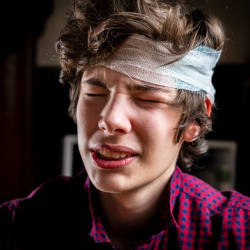 A Young Man With A Bandaged Head Expressing Discomfort, Illustrating Recovery From A Head Injury During Physiotherapy Edmonton At In Step Physical Therapy. A Young Man With A Bandaged Head Expressing Discomfort, Illustrating Recovery From A Head Injury During Physiotherapy Edmonton At In Step Physical Therapy.