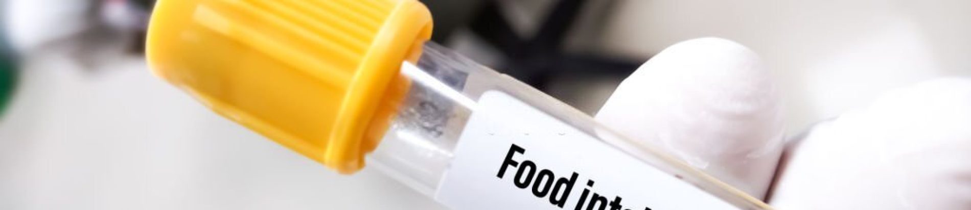 Dietary Research Edmonton